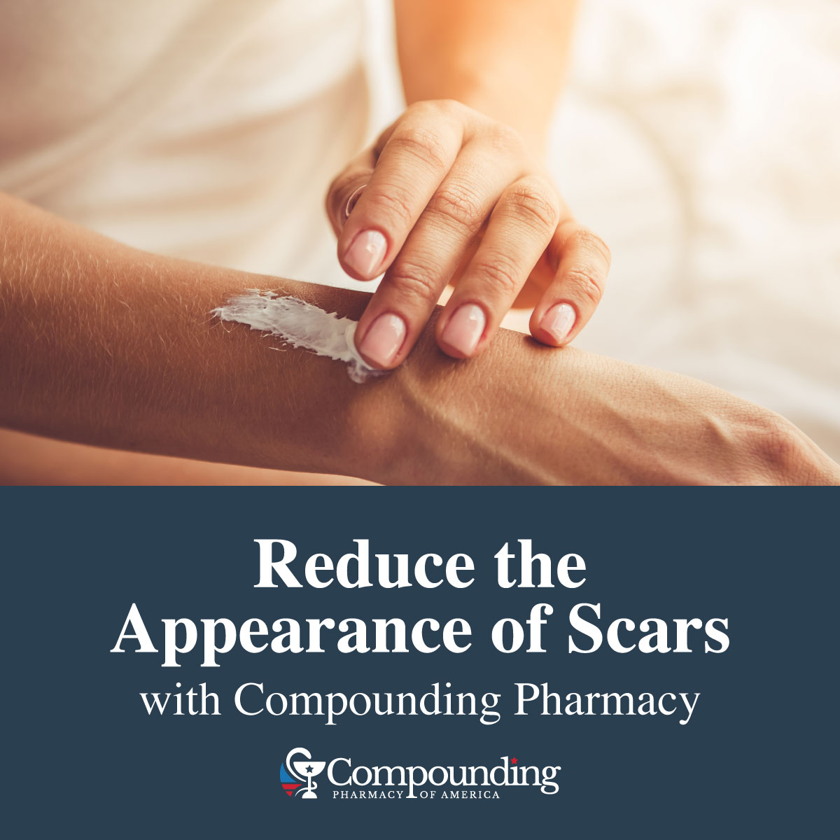 Reduce and Minimize the Appearance of Scars with Compounding Pharmacy