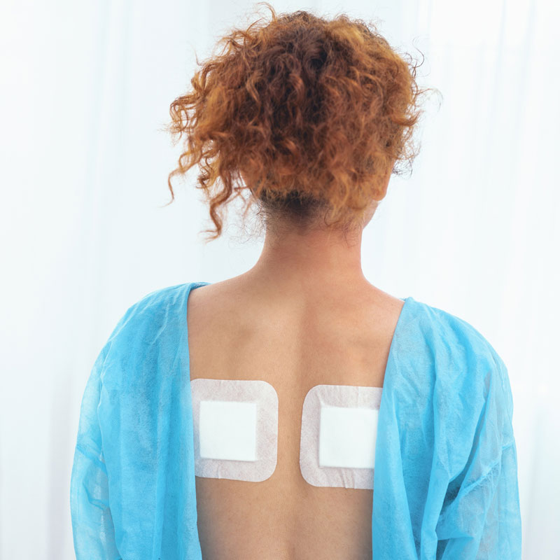 transdermal patches