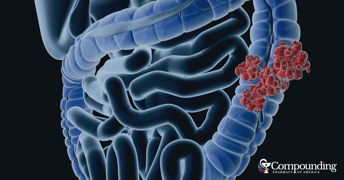 Are You Among Those at Increased Risk for Colorectal Cancer?