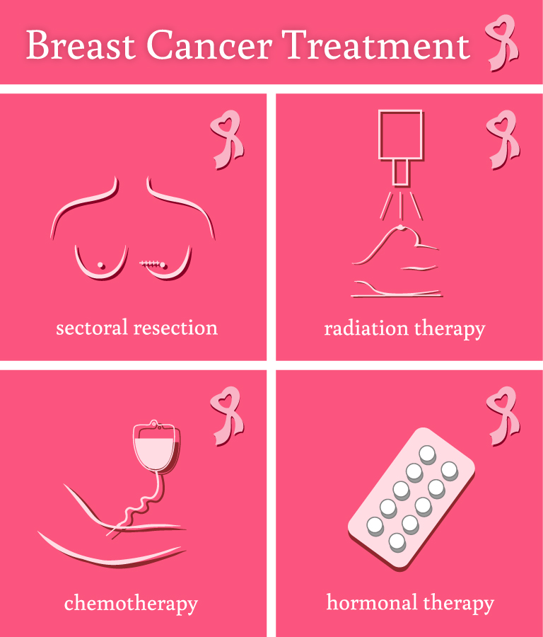 Breast Cancer Treatments