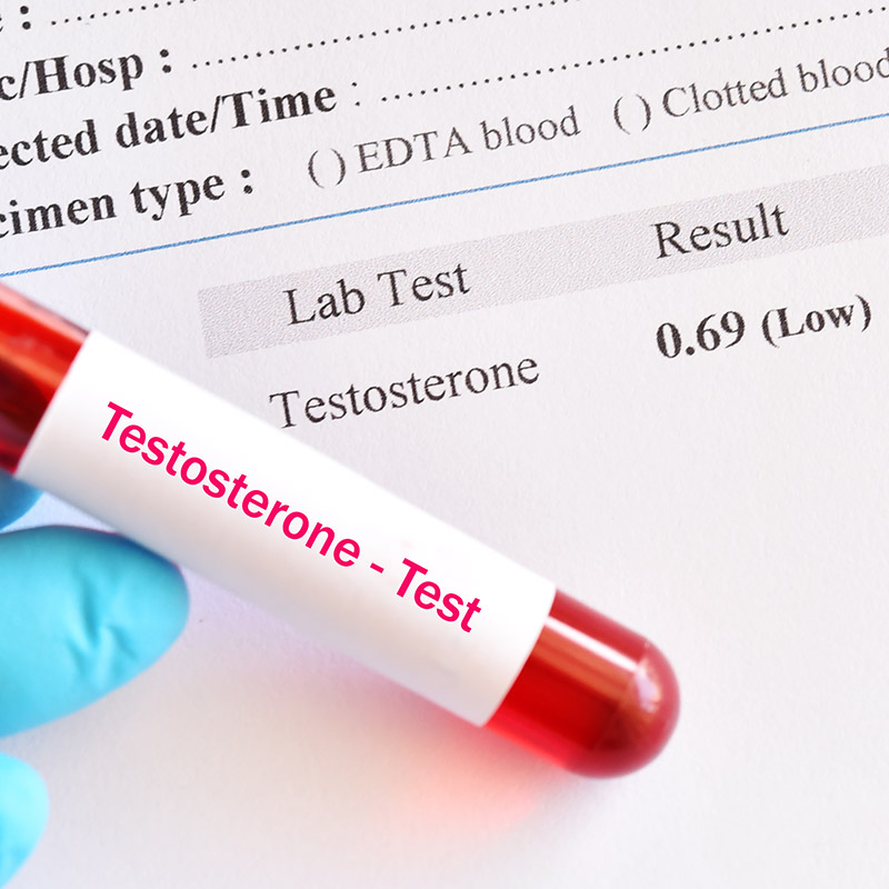 Signs and Symptoms of Low T